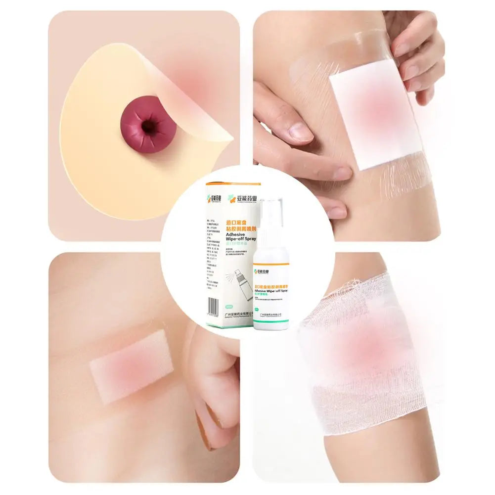 Colostomy Adhesive Wipe-Off Spray Medical Adhesive Remover Ostomy Bag Care Clean And Disinfect Skin Supplies