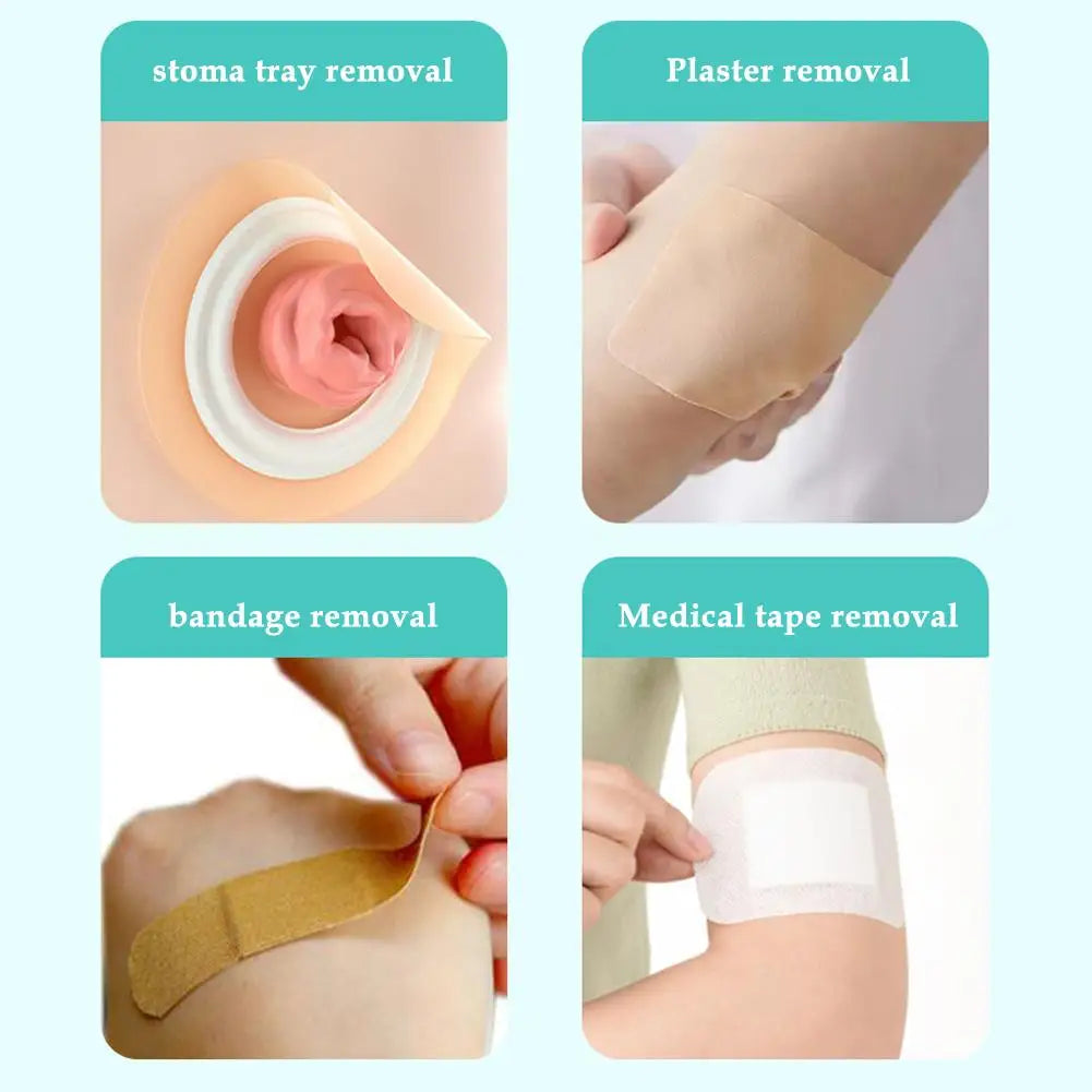 Colostomy Adhesive Wipe-Off Spray Medical Adhesive Remover Ostomy Bag Care Clean And Disinfect Skin Supplies